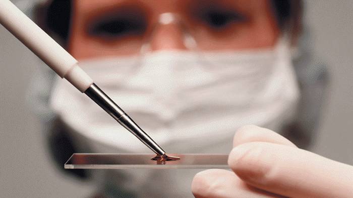 Исследование крови