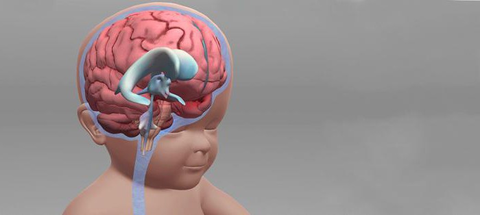 гипертензионно гидроцефальный синдром признаки