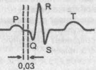 Синдром Клерка—Леви—Кристеско Синдром Клерка—Леви—Кристеско