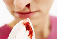 Болезнь Виллебранда