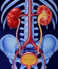 Острый пиелонефрит