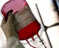 Острая кровопотеря