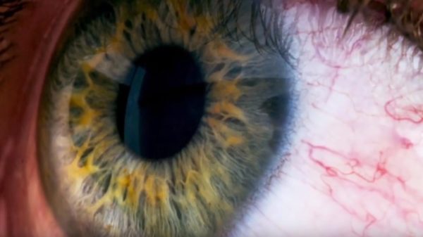 Капли для лечения синдрома сухого глаза капли для глаз