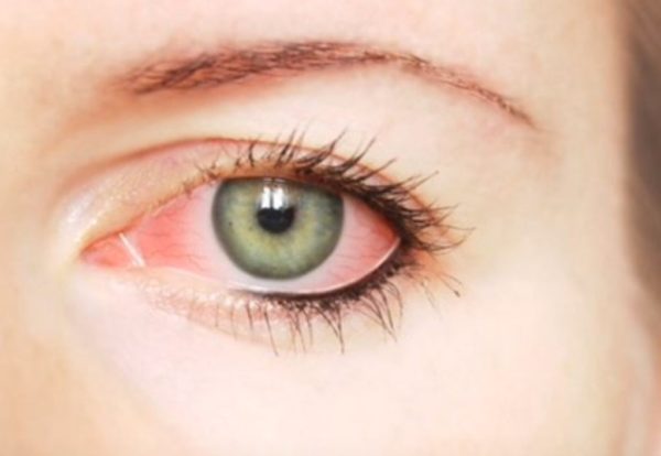 Капли для лечения синдрома сухого глаза капли для глаз