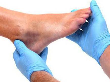 Повреждение связок правого голеностопного сустава код мкб