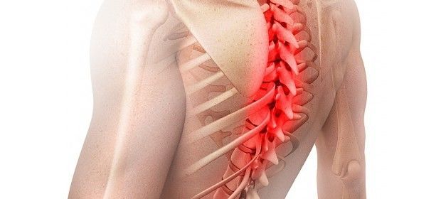 Проблемы со спиной