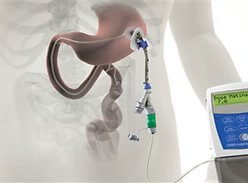 Болезнь Паркинсона теперь можно лечить новым способом