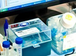 Боковой амиотрофический склероз и стволовые клетки