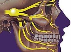 Преимущественный метод лечения невралгии тройничного нерва