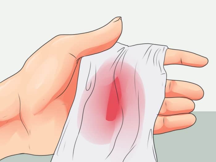 Кашель с кровью должен ускорить визит к врачу Кашель с кровью должен ускорить визит к врачу