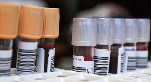 анализы на состояние